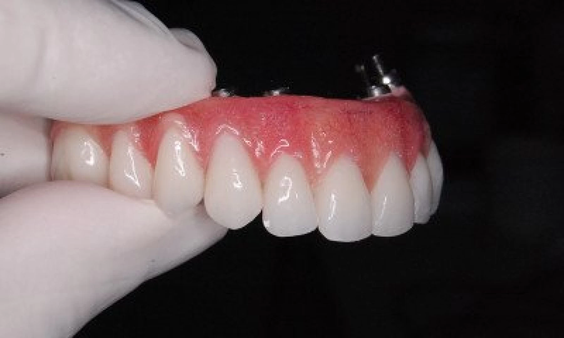 Reabilitação Dental